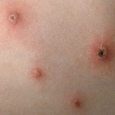 /Upload/image/2023/06/19/upload_thuy-dau-do-bi-nhiem-virus_190623-023948.png